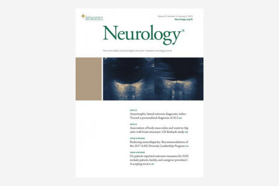 Electromagnetic Source Imaging In Presurgical Workup Of Patients With Epilepsy Konexion Snc