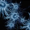 Hiperactividad Neuronal